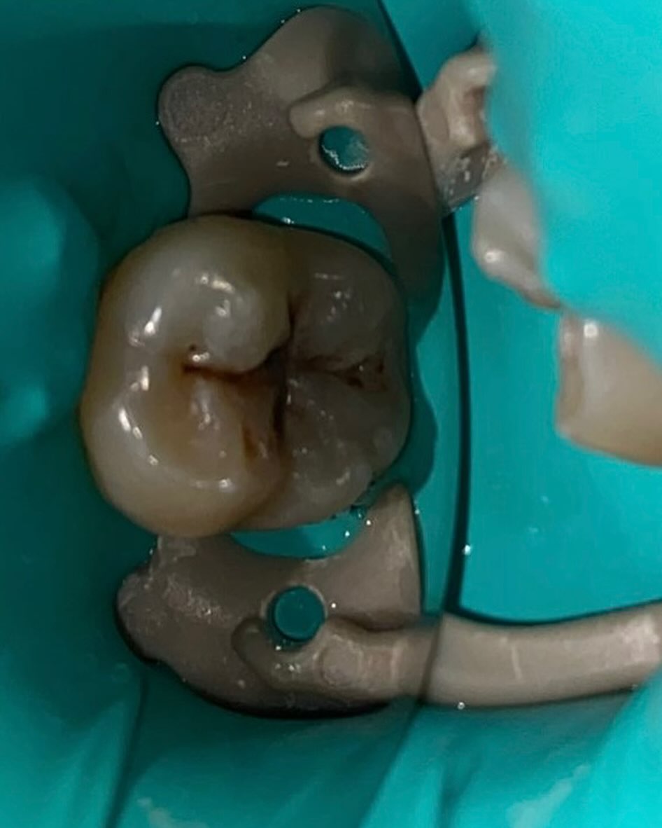 Limpieza dental en Mérida