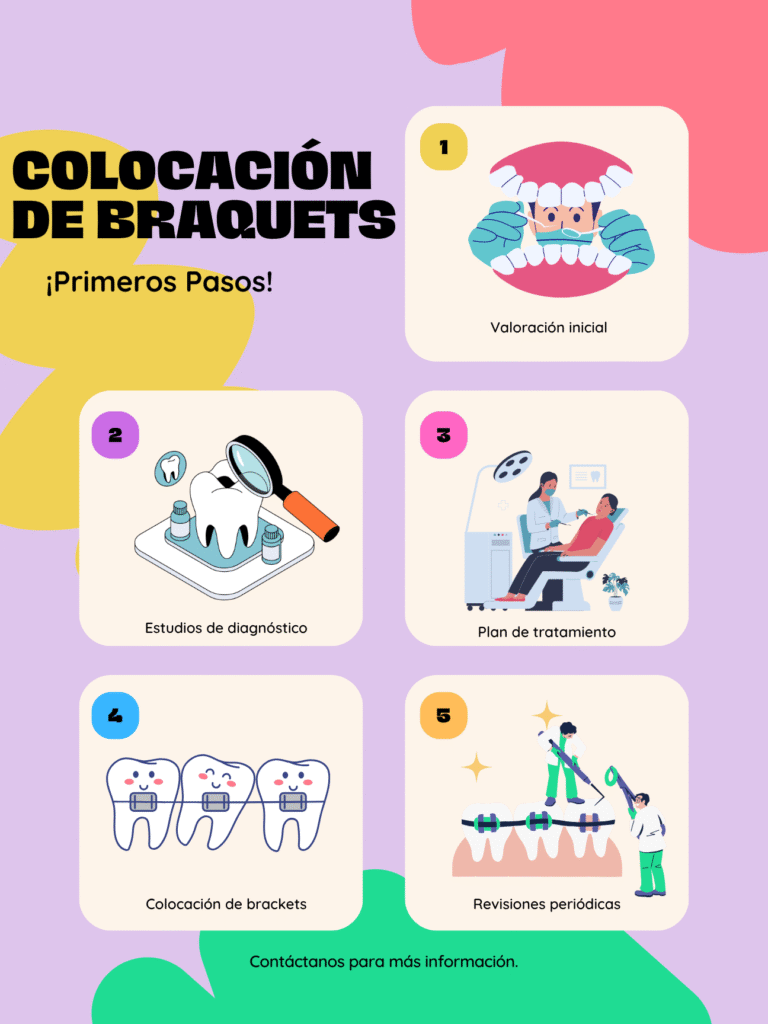 Colocación de braquets en Mérida